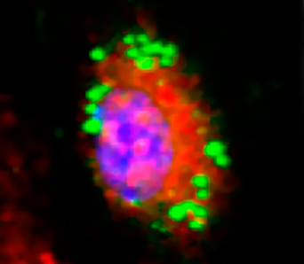 28 07 Imuno notícia proteinasHeme